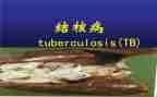 结核病工作半年总结7篇